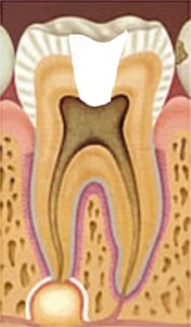 endodonzia