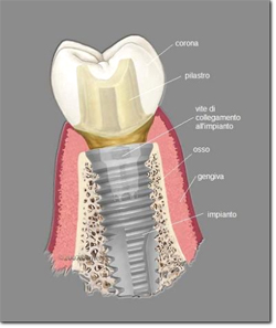 implantologia--1-